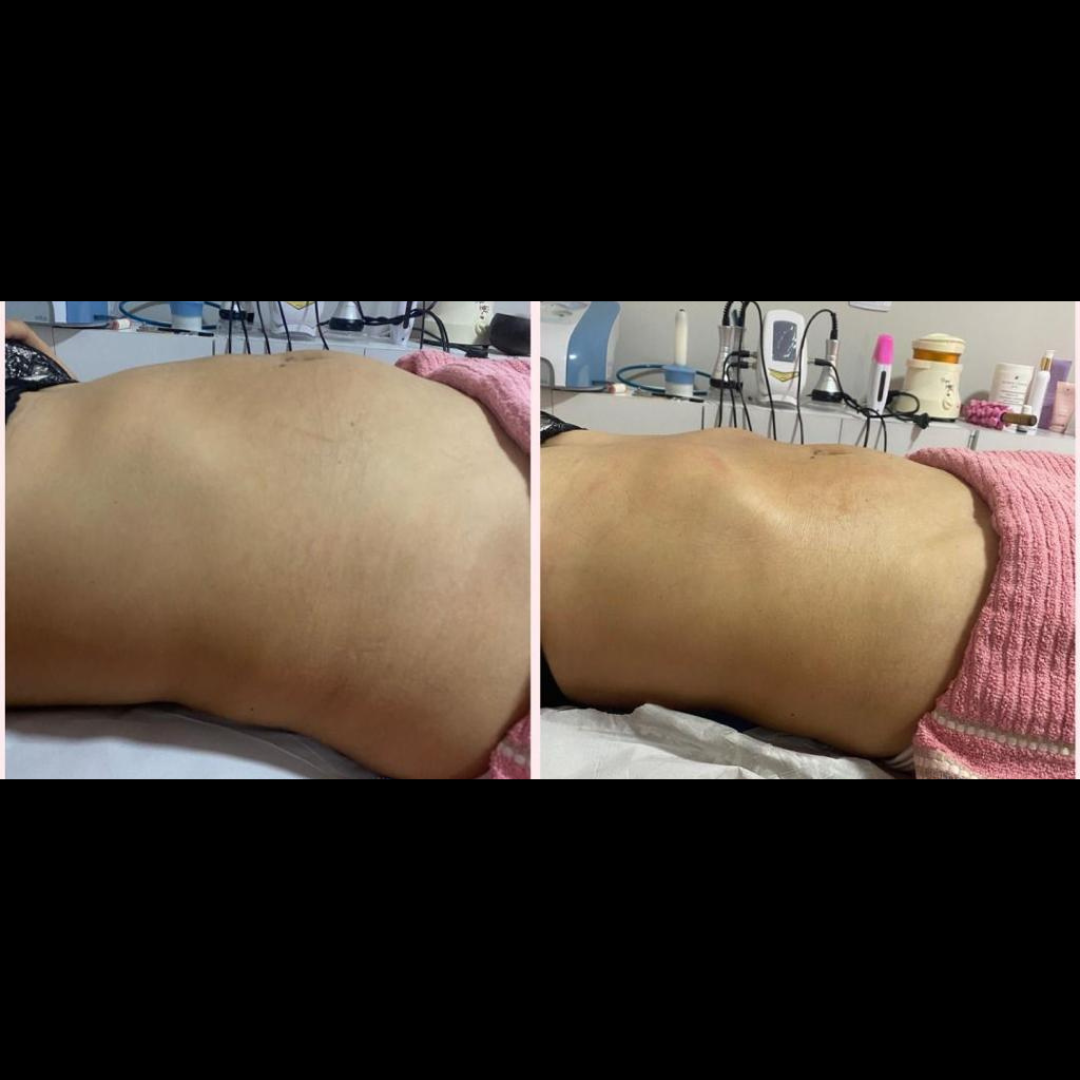 Antes e depois